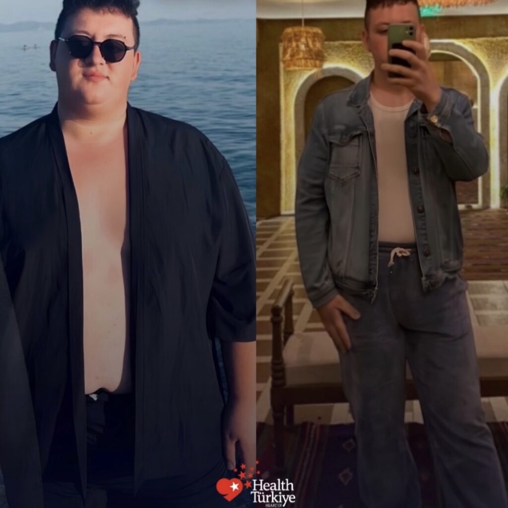 before after 5