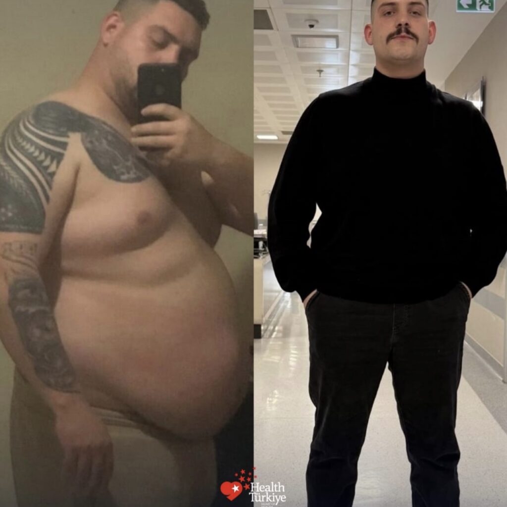 before after 9
