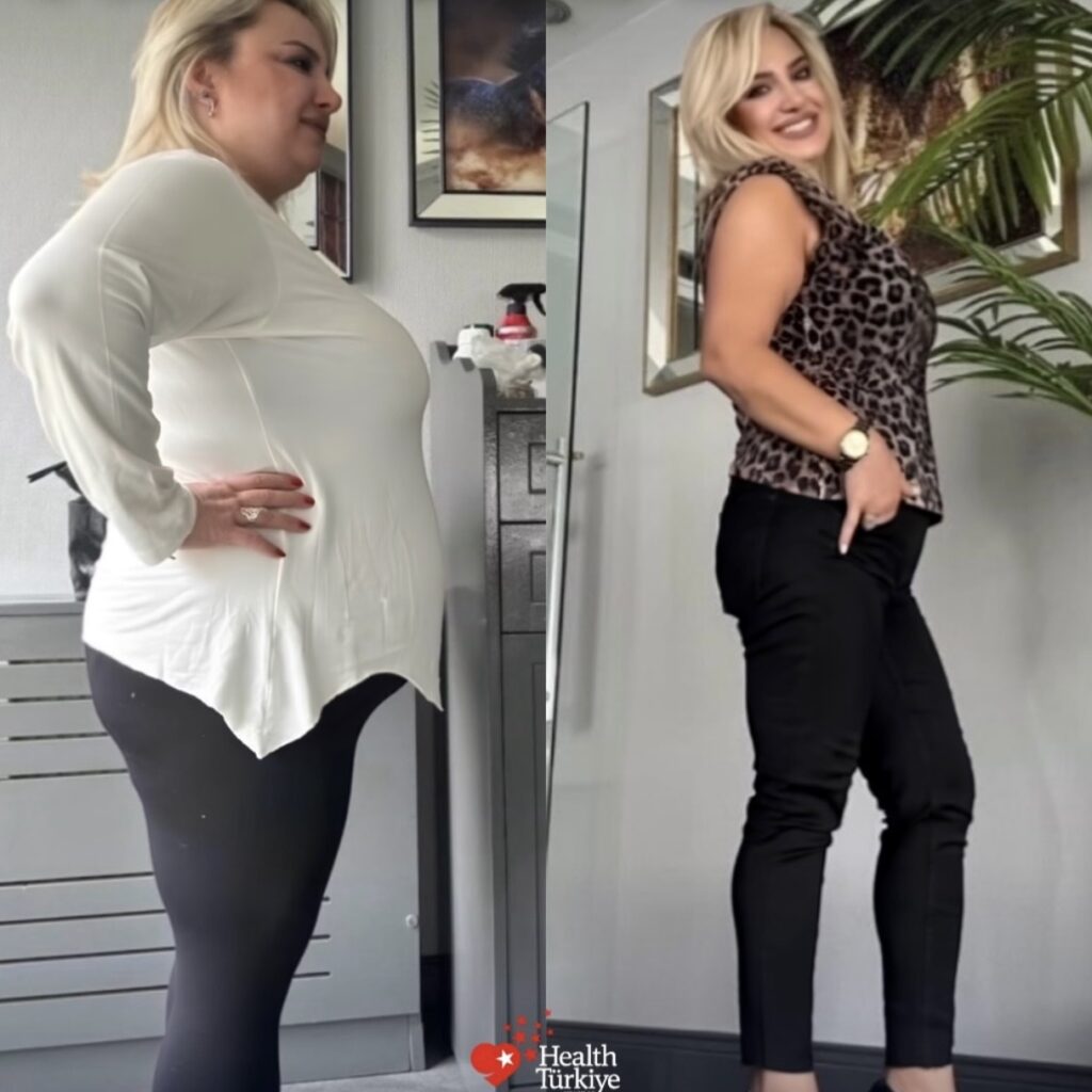 before after 4