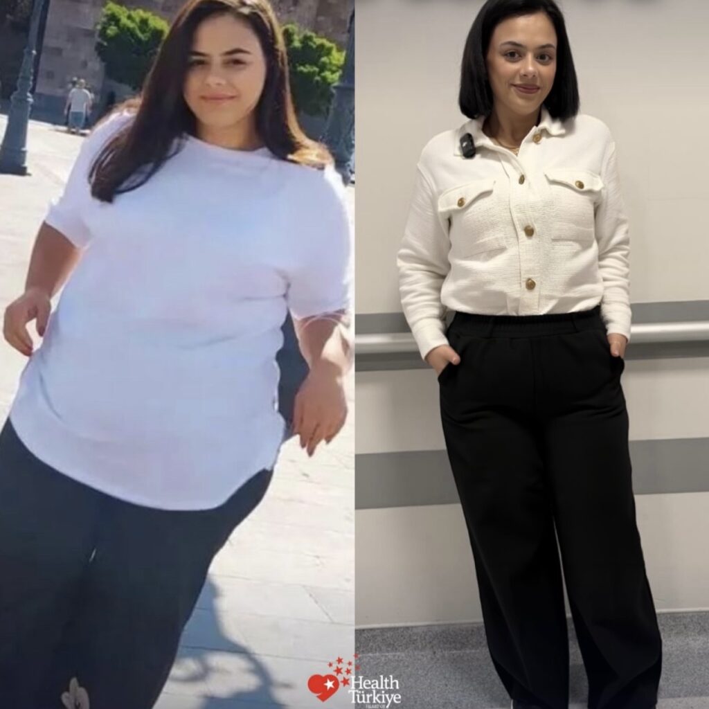 before after 3