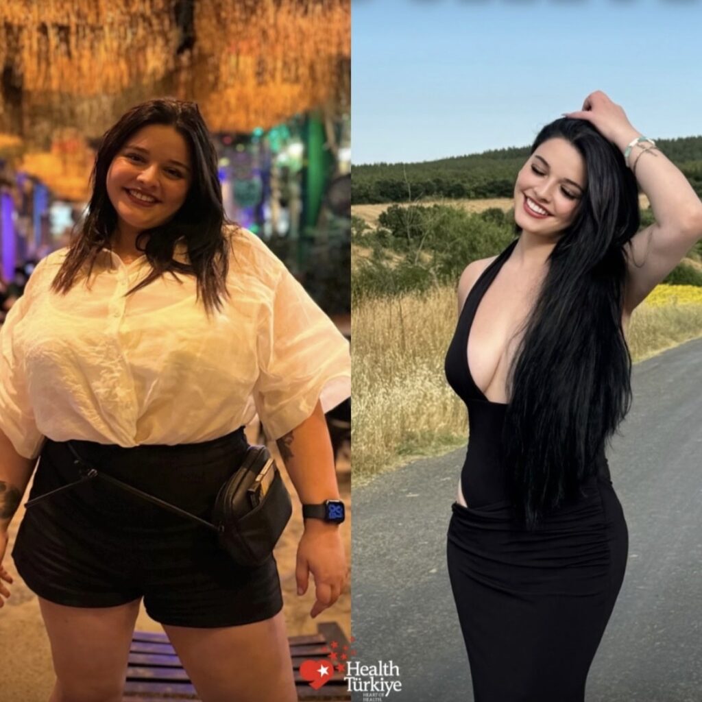before after 2