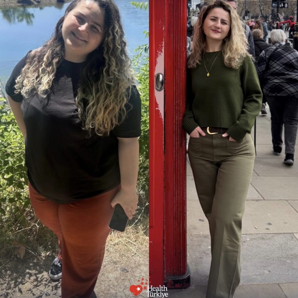 before after 7