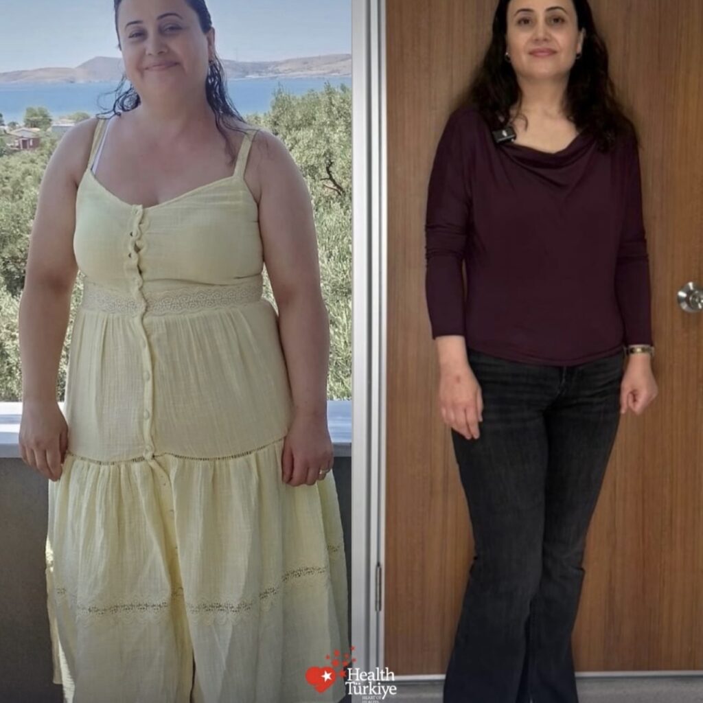 before after 8