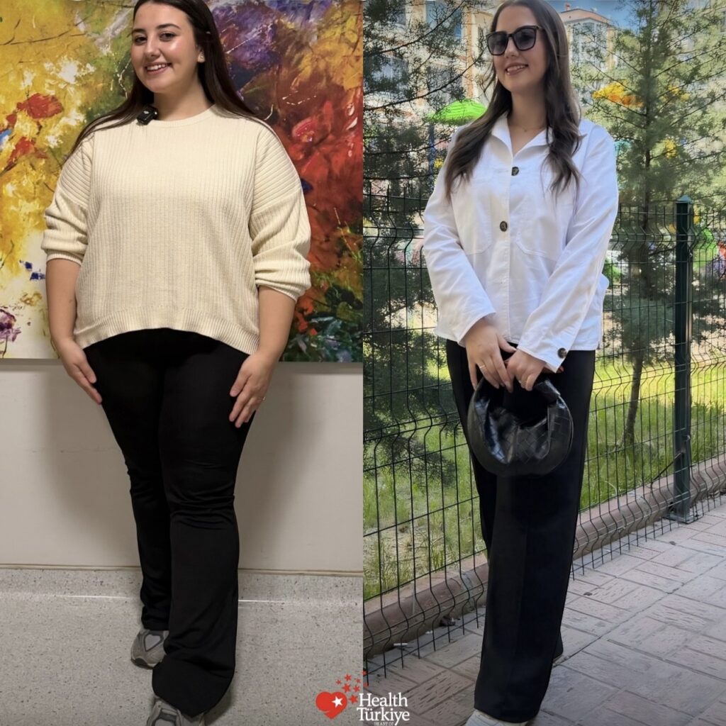 before after 10